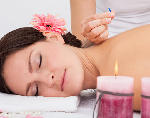 Get the Effective and Affordable Acupuncture Treatment Near Howell, MI Today!