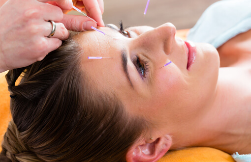 Receive the Best Acupuncture Treatment and Chinese Medicine Near You in Fenton, MI