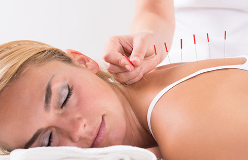 Receive the Best Acupuncture Treatment and Chinese Medicine Near You in Fenton, MI