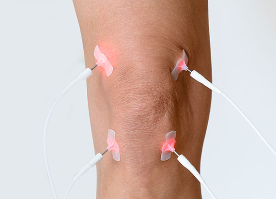 Laser acupuncture