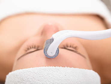 Microneedling