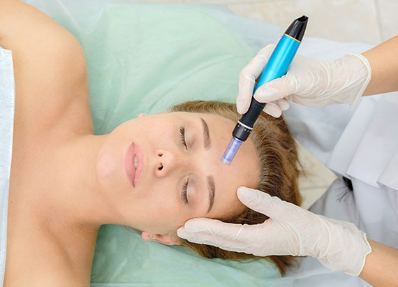Nano needling?