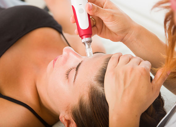 Traditional Chinese Medicine & Microneedling